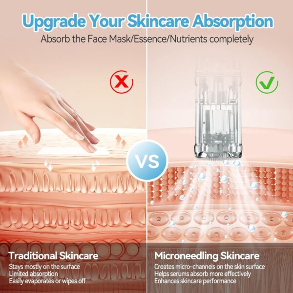 a651fd6a5sfds56165112311215sasda Agulhas Dr.Pen 36 Pinos Microneedling 10pcs para Dermapen