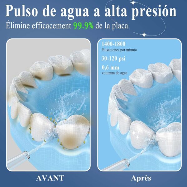 Irrigador Dental Portátil Limpeza Profissional Sem Fios SURFOU